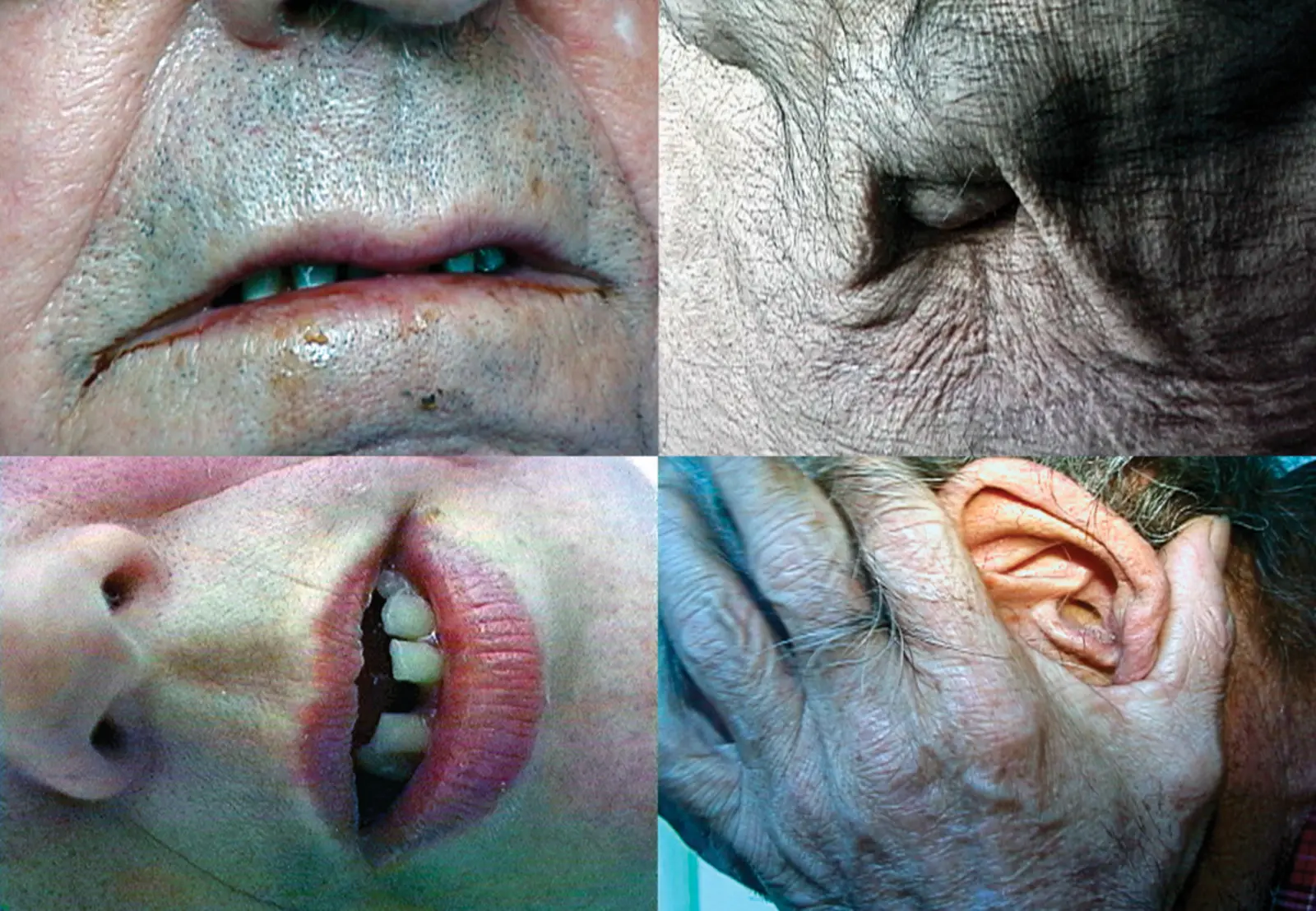[ Fig. 10] <i>Lying Quiet</i> (detail), 2004.